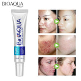Bioaqua Pureskin Acne Rejuvenation Cream, 30gm
