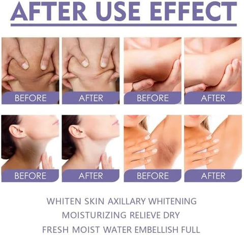 Eelhoe Whitening Skin Stick Armpit Whitening Cream