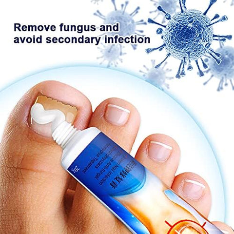 Sumifun Nail Repair Cream, Promote Nail Growth, Improves Appearance of Aging Nails, Nourishing Nail, Nail Care, 3 Count