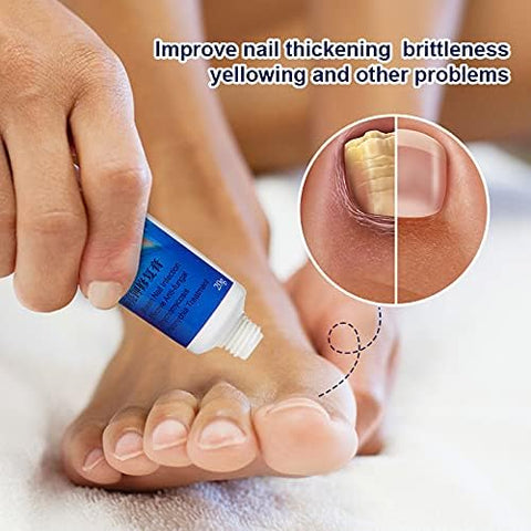 Sumifun Nail Repair Cream, Promote Nail Growth, Improves Appearance of Aging Nails, Nourishing Nail, Nail Care, 3 Count