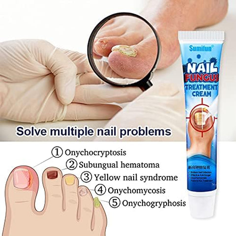 Sumifun Nail Repair Cream, Promote Nail Growth, Improves Appearance of Aging Nails, Nourishing Nail, Nail Care, 3 Count