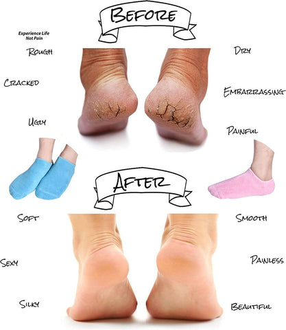 Gel Spa Socks for Repairing and Softening Dry Cracked Feet Skins