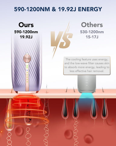 SKG Laser Hair Removal Device