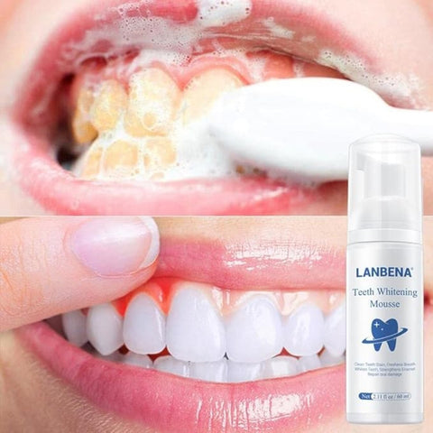 LANBENA Tooth Whitening Oral Care Foam Toothpaste Teeth Cleansing Mousse 60ml.