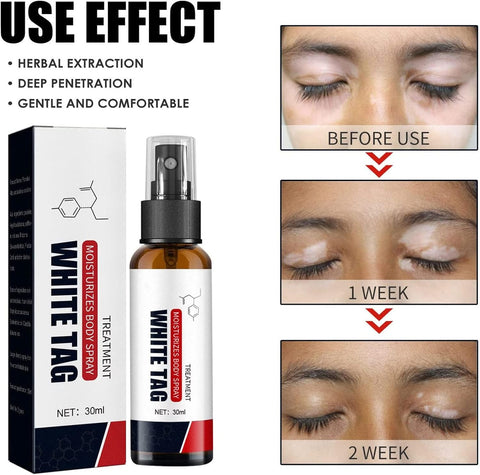 Dermax White Tag Treatment Moisturizing Body Spray