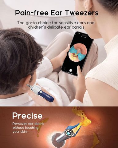 Bebird Earsight Plus Ear Wax Removal Tool Camera, Ear Cleaner with Flexible Wireless Ear Camera Otoscope