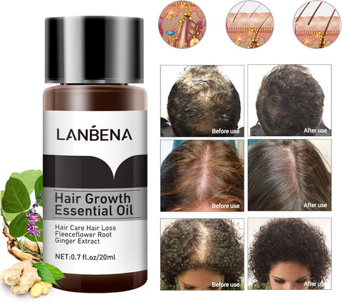 LANBENA Hair Growth Essencial Oil Organic Hair Growth Oils for Hair Thickening