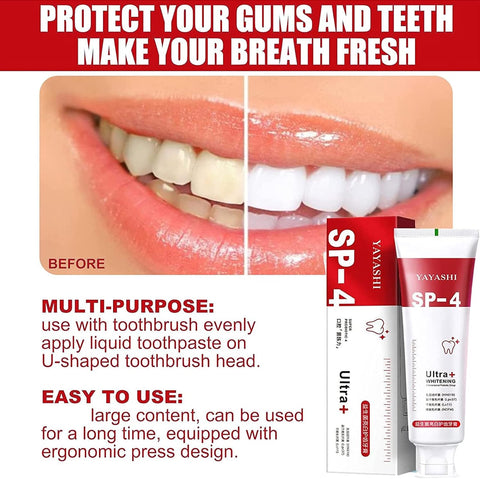 Yayashi Sp-4 Breath Toothpaste, Brightening & Stain Removing Toothpaste, Protects Gums Freshens Breath (MIX)