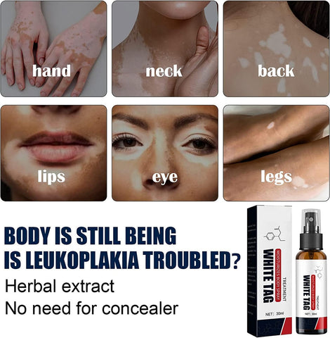 Dermax White Tag Treatment Moisturizing Body Spray