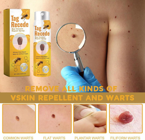 Tag Recede, Bee Venom Spray