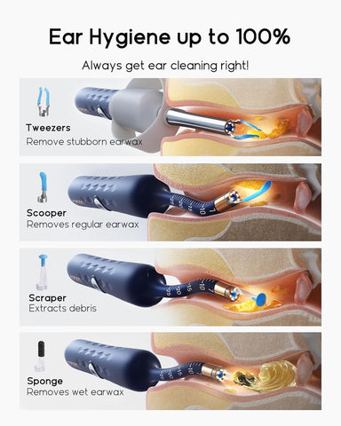Bebird Earsight Plus Ear Wax Removal Tool Camera, Ear Cleaner with Flexible Wireless Ear Camera Otoscope