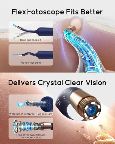 Bebird Earsight Plus Ear Wax Removal Tool Camera, Ear Cleaner with Flexible Wireless Ear Camera Otoscope