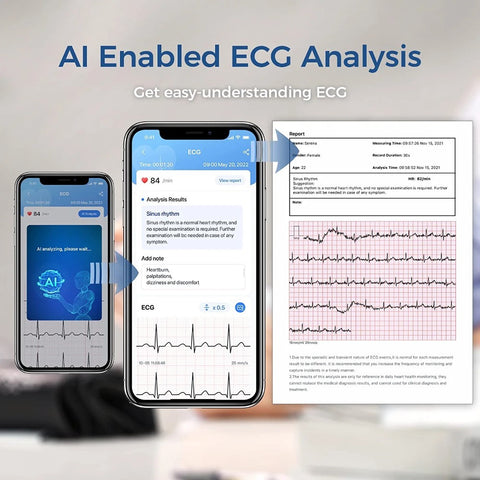 Wellue BP2 Connetc Blood Pressure Monitor with ECG