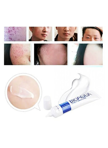 BIOAQUA Premium Quality Acne-Pimple Removal Cream
