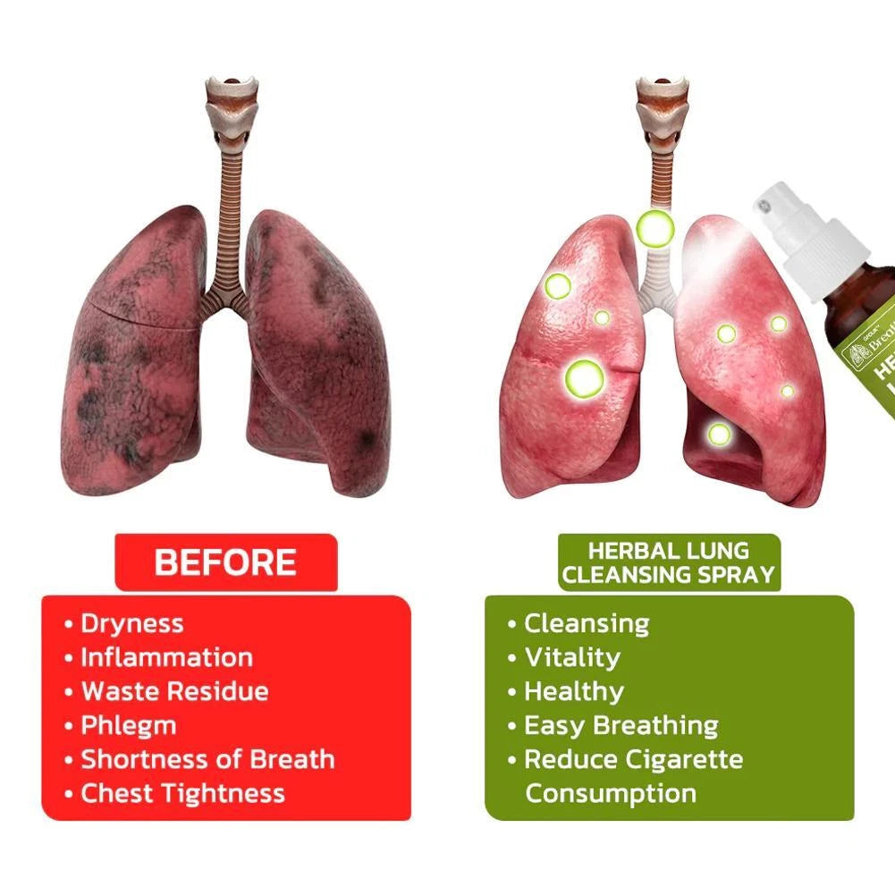 Breathdetox Herbal Lung Cleansing Spray
