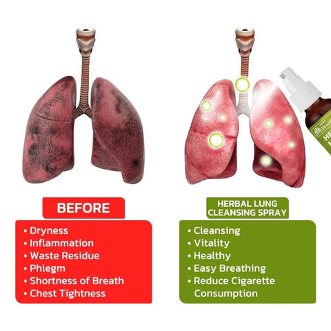 Breathdetox Herbal Lung Cleansing Spray