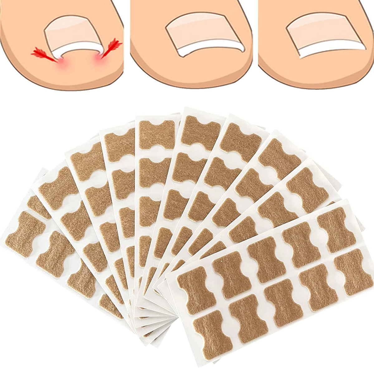 100PCS Toenail Corrector Patch,Ingrown Toe Nail Correction Sticker