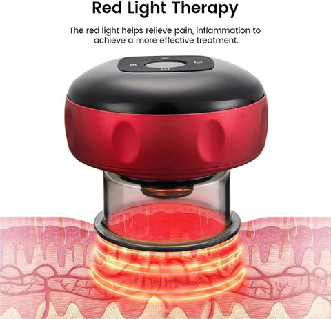 Intelligent Breathing Cupping Massage Instrument The Smart Cupping Therapy Massager - (Red)